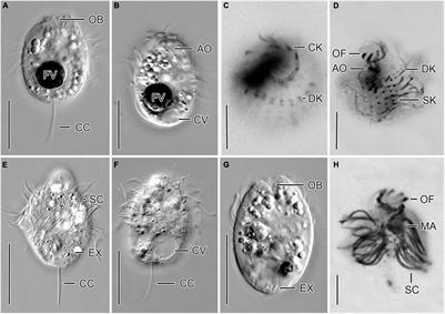 Molecular Data Reveal a Cryptic Diversity in the Genus Urotricha (Alveolata, Ciliophora, Prostomatida), a Key Player in Freshwater Lakes, With Remarks on Morphology, Food Preferences, and Distribution